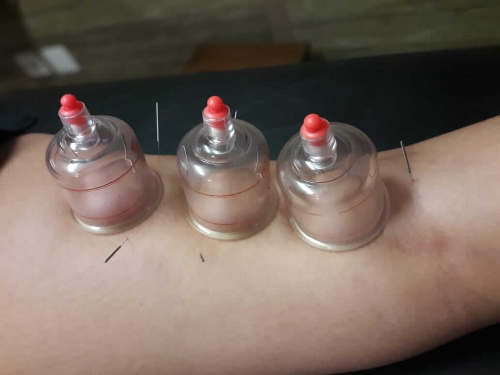 Ventosas em detalhe
